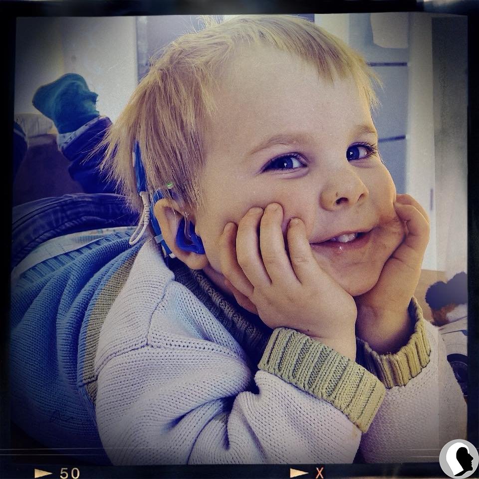 CI Kopf 2018 männlich Kind